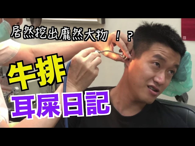 牛排耳屎日記!「 居然幫我挖出這麼大顆的 」